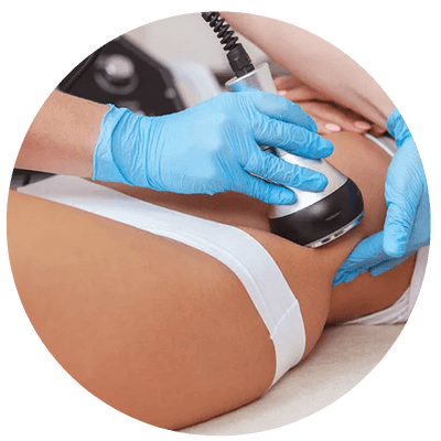 Lipocavitação Corporal BH e Matozinhos - MG | Redução de Gordura e Modelagem