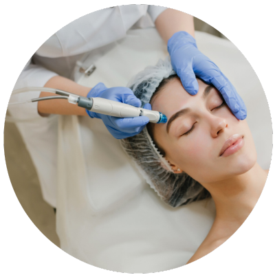 Microagulhamento em BH | Tratamento para Rejuvenescimento e Cicatrizes