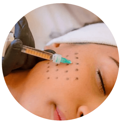 Skinbooster em Belo Horizonte e Matozinhos - MG | Hidratação Profunda da Pele